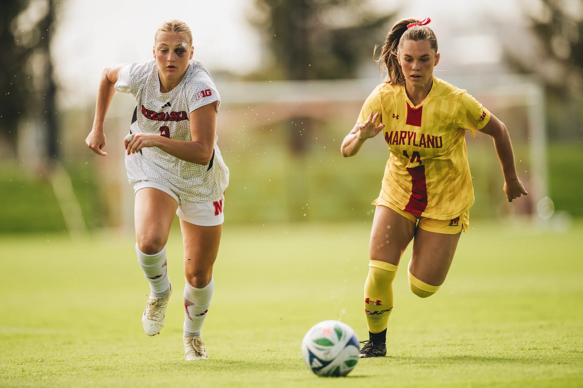 A Nebraska Cornhuskers forward, sporting a black eye, sprints alongside a Maryland defender.
